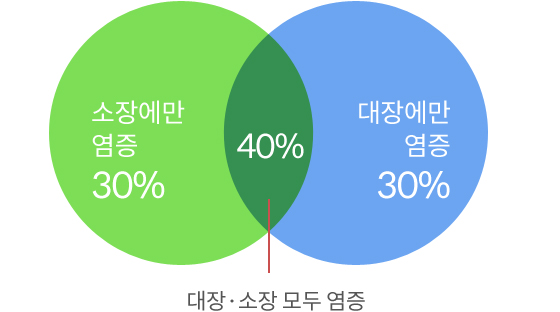 탈장이미지